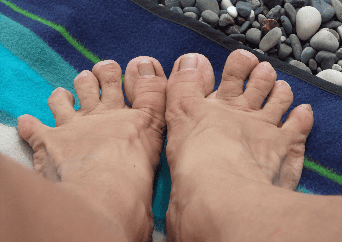 Does It Matter If My Feet Are Ugly To Sell Feet Pics